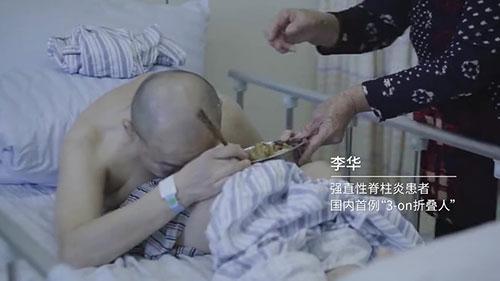 身體被敲斷4次的折疊人出院，打開折疊人生(圖2)