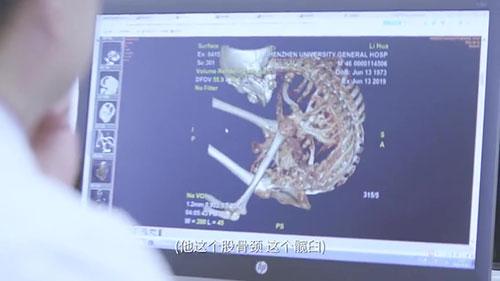 身體被敲斷4次的折疊人出院，打開折疊人生(圖6)