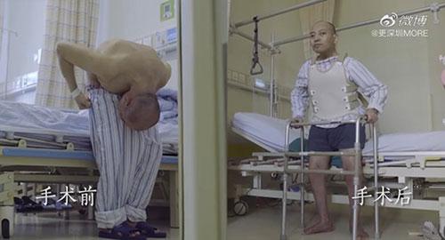 身體被敲斷4次的折疊人出院，打開折疊人生(圖15)
